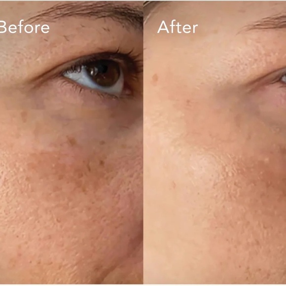 KAT BURKI Vitamin C Intensive Face Cream 1 oz. NEW - Picture 6 of 9